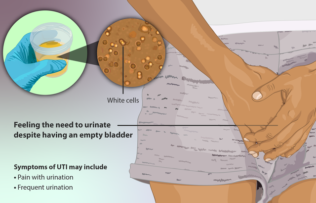 get rid of urinary tract infection (UTI)