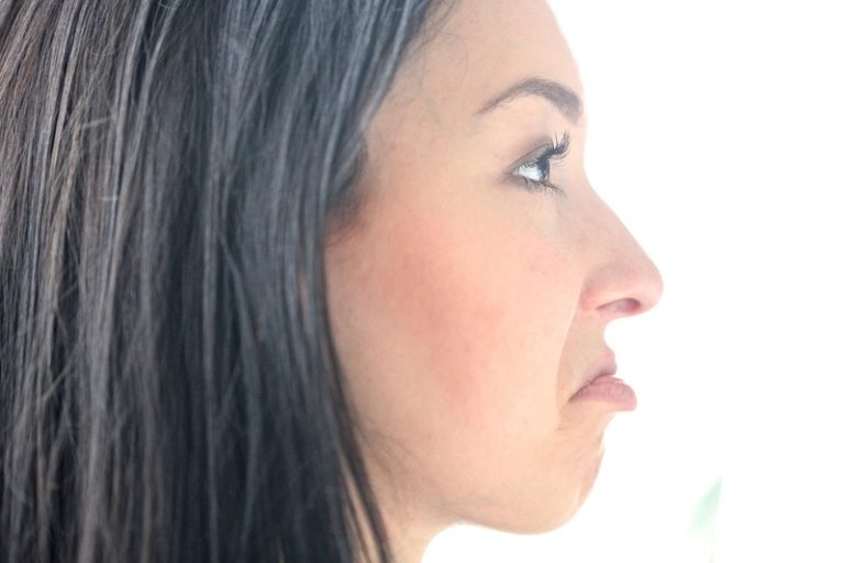 8 Effective Home Remedies For PCOS Facial Hair!