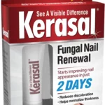 fungal nail1